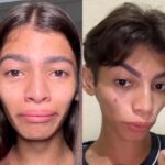 Imagem Reprodução - Ex-mulher trans; Carlos Emanuel retira protese mamaria