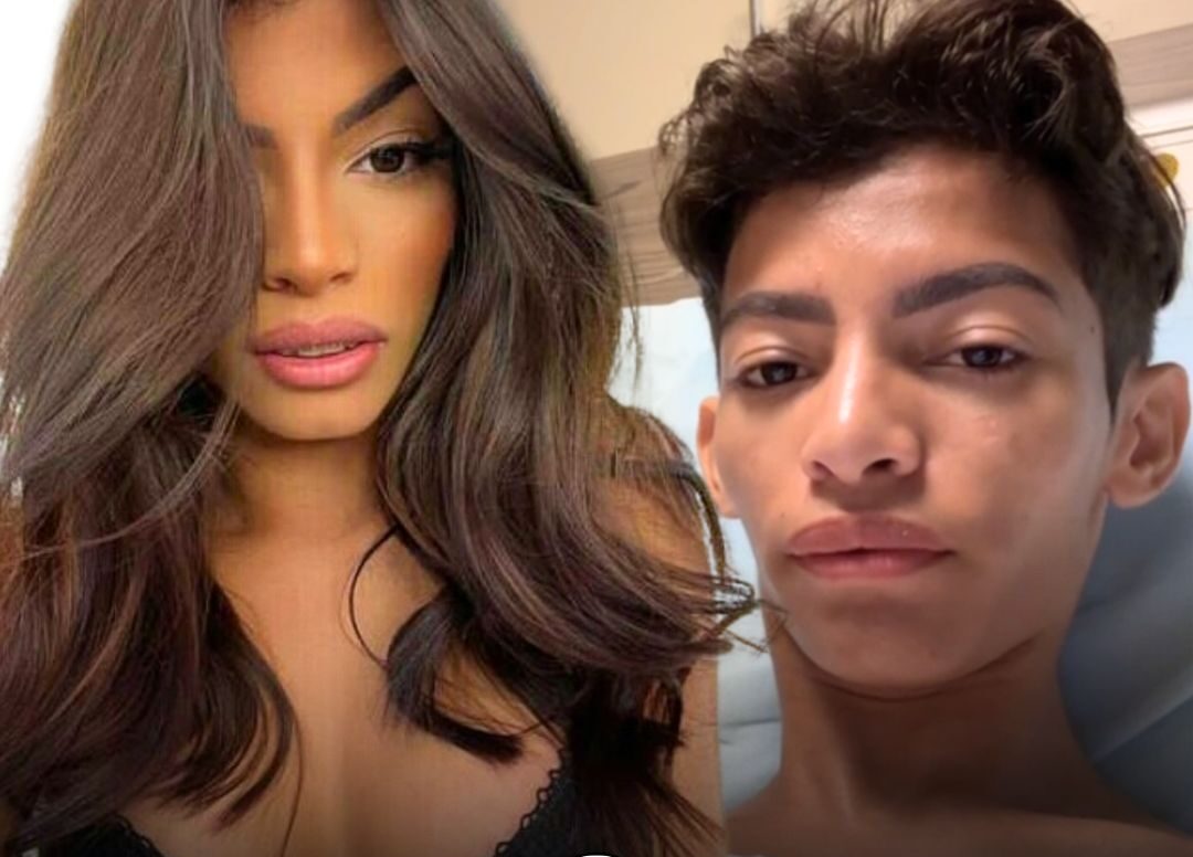 Imagem Reprodução - Ex-mulher trans; Carlos Emanuel retira protese mamaria