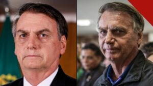 Jair Bolsonaro em 2019 e em 2025, em montagem que compara o rosto nas duas épocas, no debate sobre a suposta rinoplastia de Bolsonaro